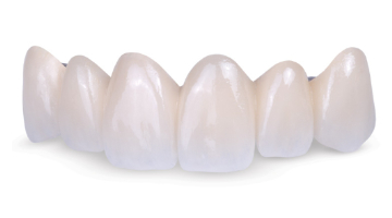 Content Dam Diq Online Articles 2016 09 Glidewell Obsidian Diqthumb