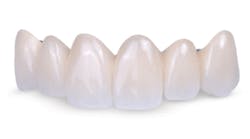 Content Dam Diq Online Articles 2016 09 Glidewell Obsidian Diqthumb Content Dam Diq Online Articles 2016 09 Glidewell Obsidian Diqthumb