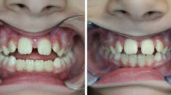 Content Dam Diq Online Articles 2016 09 Lehman 9 16 Thumb Content Dam Diq Online Articles 2016 09 Lehman 9 16 Thumb