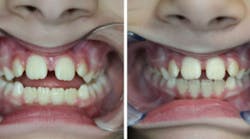 Content Dam Diq Online Articles 2016 09 Lehman 9 16 Thumb Content Dam Diq Online Articles 2016 09 Lehman 9 16 Thumb