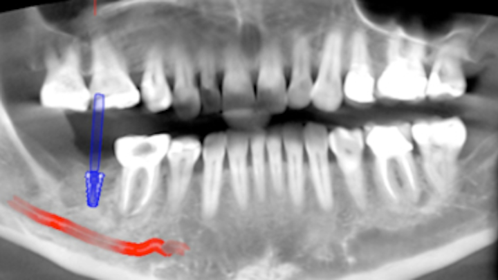 Content Dam Diq Online Articles 2016 09 Scardella Cbct Diqthumb