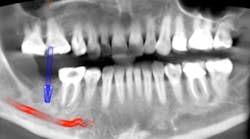 Content Dam Diq Online Articles 2016 09 Scardella Cbct Diqthumb Content Dam Diq Online Articles 2016 09 Scardella Cbct Diqthumb