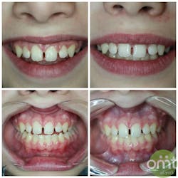 Lehman 9 16 Case 2 Lehman 9 16 Case 2