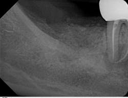 Scardella Cbct Fig01 Scardella Cbct Fig01