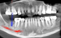 Scardella Cbct Fig02 Scardella Cbct Fig02
