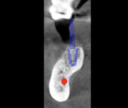 Scardella Cbct Fig03 Scardella Cbct Fig03
