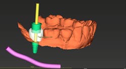 Scardella Cbct Fig04 Scardella Cbct Fig04