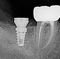 Scardella Cbct Fig05 Scardella Cbct Fig05