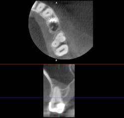 Scardella Cbct Fig06 Scardella Cbct Fig06
