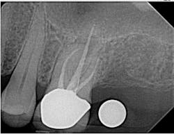 Scardella Cbct Fig07 Scardella Cbct Fig07