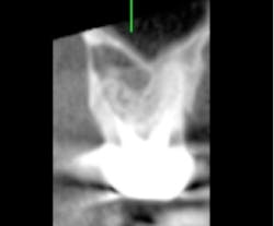 Scardella Cbct Fig08 Scardella Cbct Fig08
