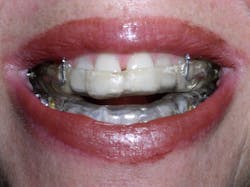 16oct6bcsmith01 16oct6bcsmith01