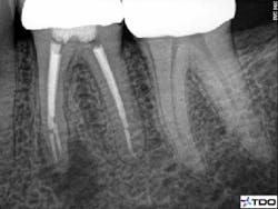 16oct6bczuroff02 16oct6bczuroff02