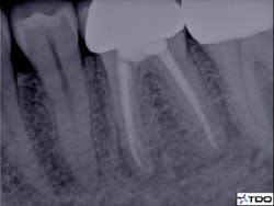 16oct6bczuroff03 16oct6bczuroff03