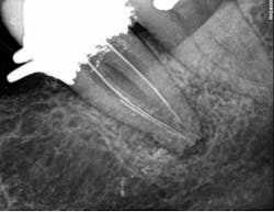 16oct6bczuroff05 16oct6bczuroff05