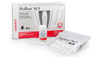 Content Dam Diq Online Articles 2016 10 Bioroot Rcs Septodont Diqthumb