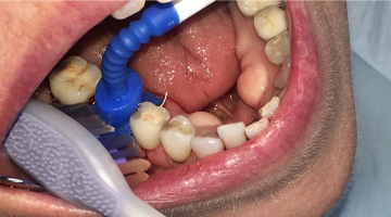 Content Dam Diq Online Articles 2016 10 Mouth Mate Diqthumb