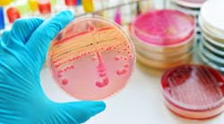 Content Dam Diq Online Articles 2016 11 Identify Bacteria T