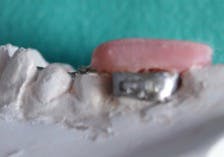 16nov15sidana03b 16nov15sidana03b