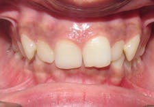 16nov15sidana04a 16nov15sidana04a