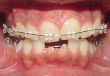 16nov15sidana04b 16nov15sidana04b