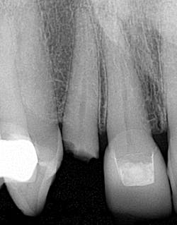 16nov3bcsimmons03 16nov3bcsimmons03