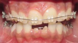 Content Dam Diq Online Articles 2016 11 16nov15sidanat Content Dam Diq Online Articles 2016 11 16nov15sidanat