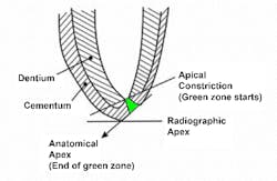 Deutsch Gutta Percha Point End Deutsch Gutta Percha Point End