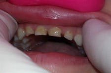 Heroic Dent Leigh01 Heroic Dent Leigh01