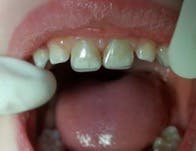 Heroic Dent Leigh02 Heroic Dent Leigh02