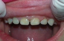 Heroic Dent Leigh04 Heroic Dent Leigh04