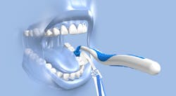 Mouth Mate Fig04 Rsz Mouth Mate Fig04 Rsz