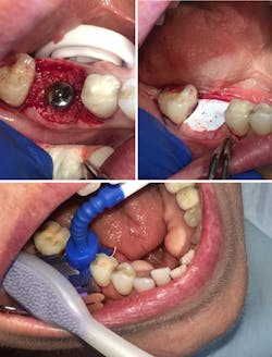 Mouth Mate Figs 01 02 03 Mouth Mate Figs 01 02 03