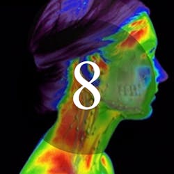 08thermography02