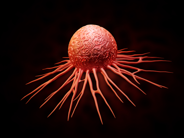 Pancreatic Cancer Oral Bacteria Dentistryiq