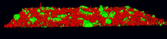 Uol Biofilm 1