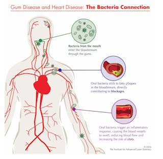 8 Steps to Prevent Heart Disease and Stroke Infographic