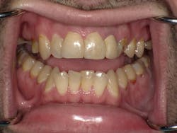 Collins Case Study Jan2016 2 Collins Case Study Jan2016 2