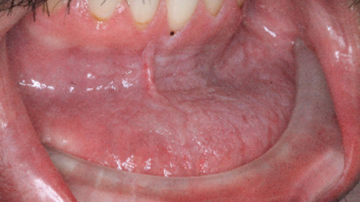 Content Dam Diq Online Articles 2017 01 17jan5bcpathcase22 Thumb