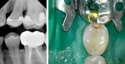 Glor Canary Fig01 02 Glor Canary Fig01 02