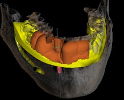 17mar2bcpaghdiwala P04 17mar2bcpaghdiwala P04