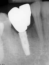 17mar2bcpaghdiwala P09 17mar2bcpaghdiwala P09