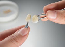 3m Lava Esthetic 3m Lava Esthetic