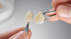 Content Dam Diq Online Articles 2017 02 3m Lava Esthetic Diqthumb Content Dam Diq Online Articles 2017 02 3m Lava Esthetic Diqthumb