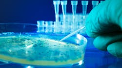 Content Dam Diq Online Articles 2017 02 Bacterial Colonies Dreamstime Thumb Content Dam Diq Online Articles 2017 02 Bacterial Colonies Dreamstime Thumb