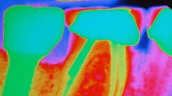 Content Dam Diq Online Articles 2017 02 Implant Basics Diqthumb Content Dam Diq Online Articles 2017 02 Implant Basics Diqthumb