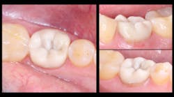 Content Dam Diq Online Articles 2017 02 Pmm Novy Gi Diqthumb Content Dam Diq Online Articles 2017 02 Pmm Novy Gi Diqthumb