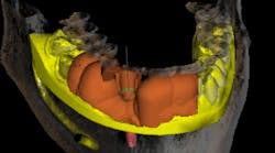 Content Dam Diq Online Articles 2017 03 17mar2bcpaghdiwala Thumb Content Dam Diq Online Articles 2017 03 17mar2bcpaghdiwala Thumb