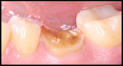 Pmm Novy Gi Fig01 Pmm Novy Gi Fig01