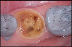 Pmm Novy Gi Fig04 Pmm Novy Gi Fig04